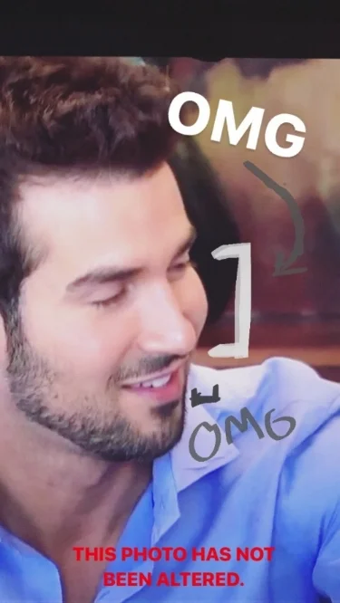 BRYAN IS NOT A GOOD PERSON. Also, he has these intense fillers that are really obvious when he turns to the side. 