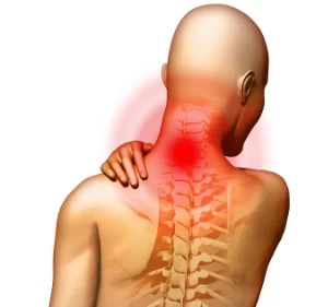 bigstock-X-Ray-Anatomy-Painful-Neck-2512323.jpg
