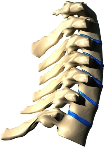 bigstock-inflamed-neck-6989506.jpg