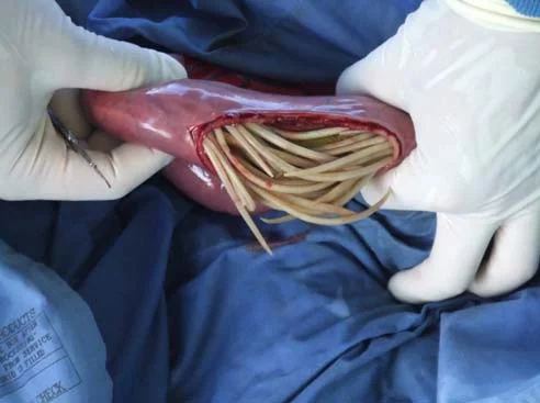 ascarid.jpg