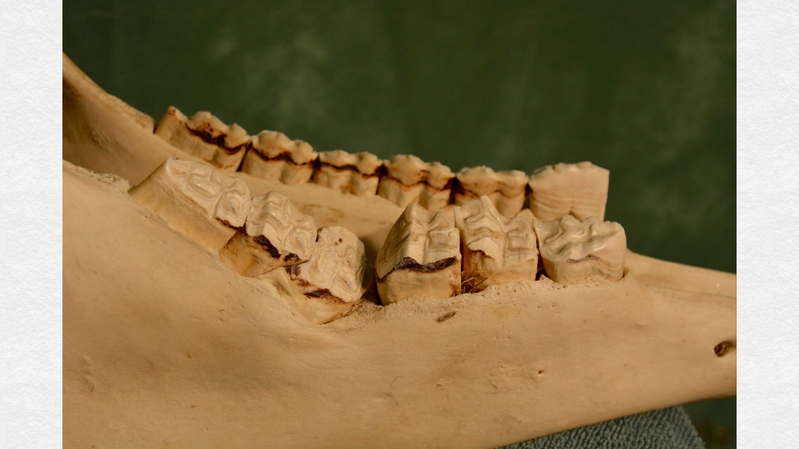 Affected lower jaw