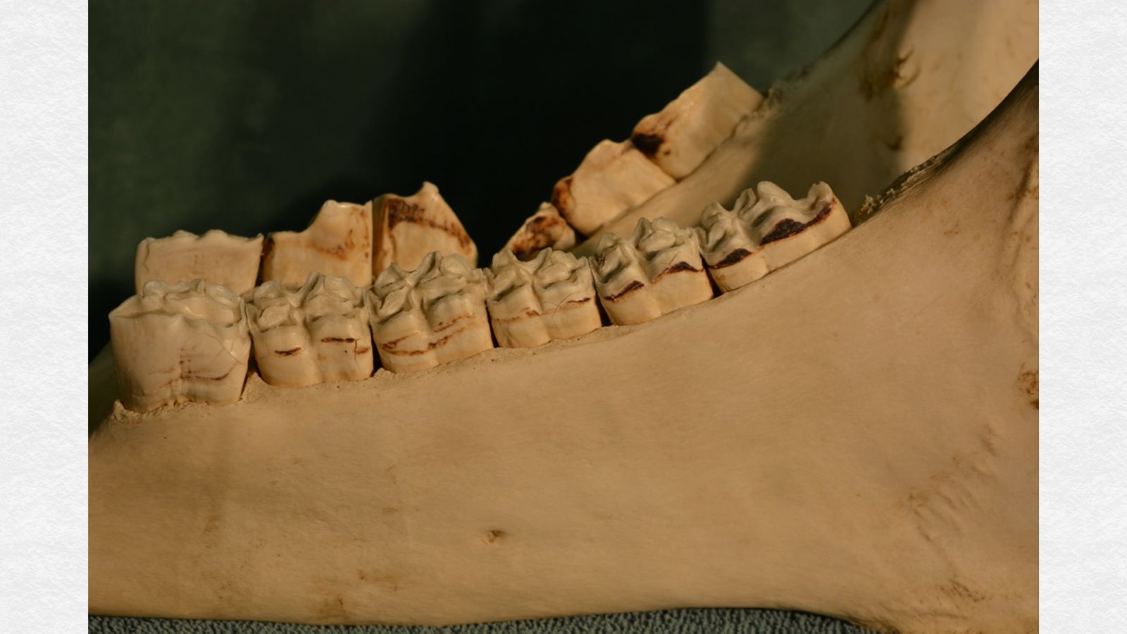 Compare the findings above with the smooth, level contour of the bone of the unaffected side (foreground).