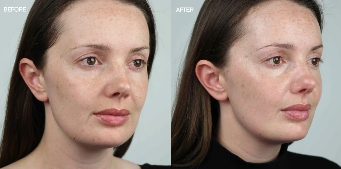 Focus On Flawless With Environ Skin Care Product Review Maria De Vos