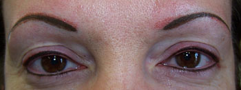 Adjusted shape and exfoliated color
