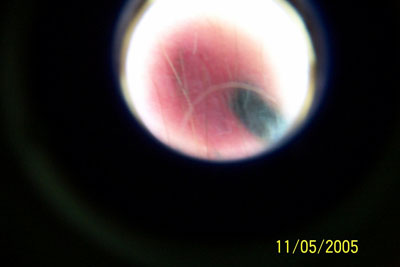 9) Bump #2