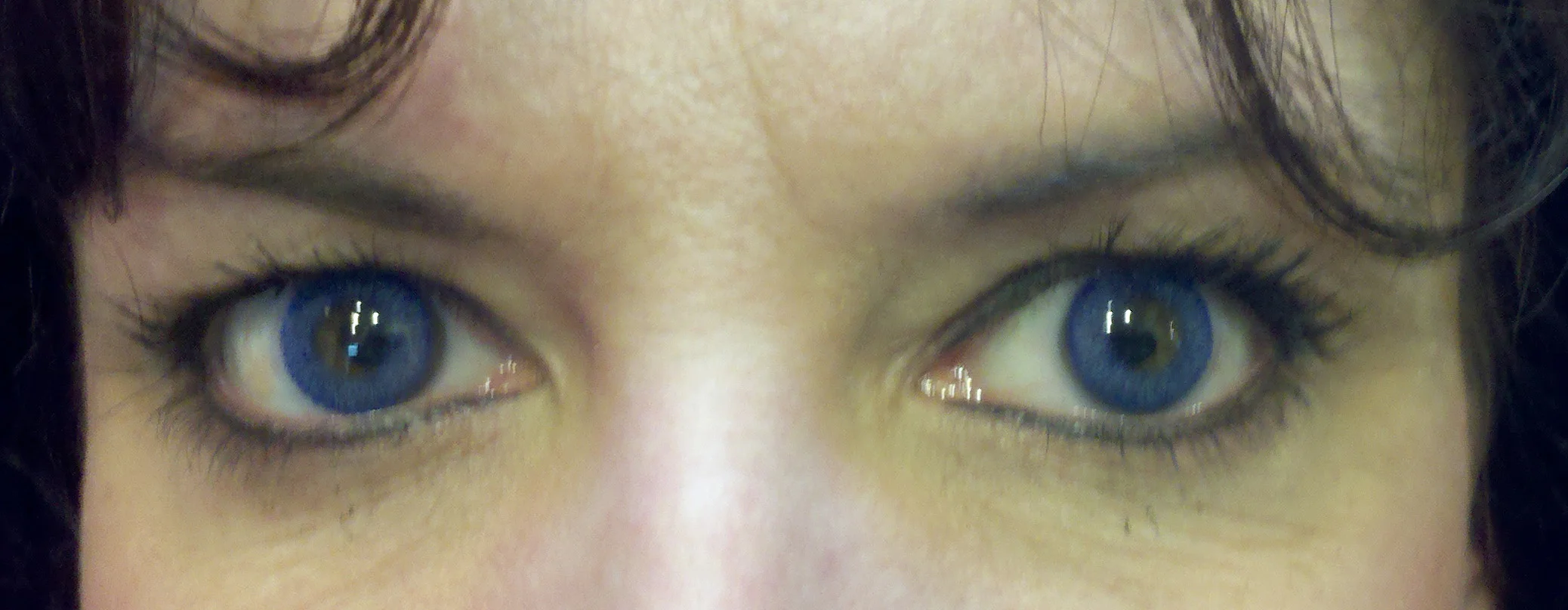 brows 30 healed.jpg
