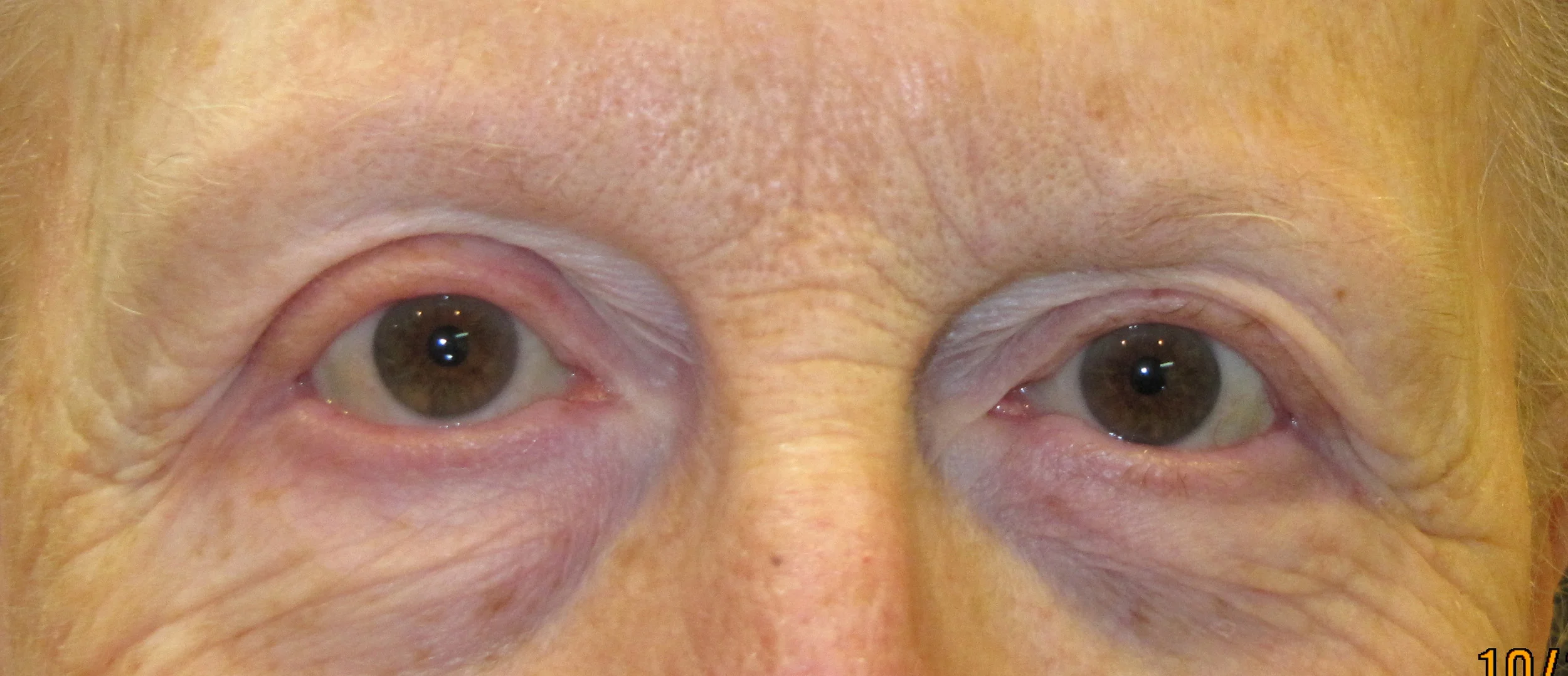 brows 31.jpg