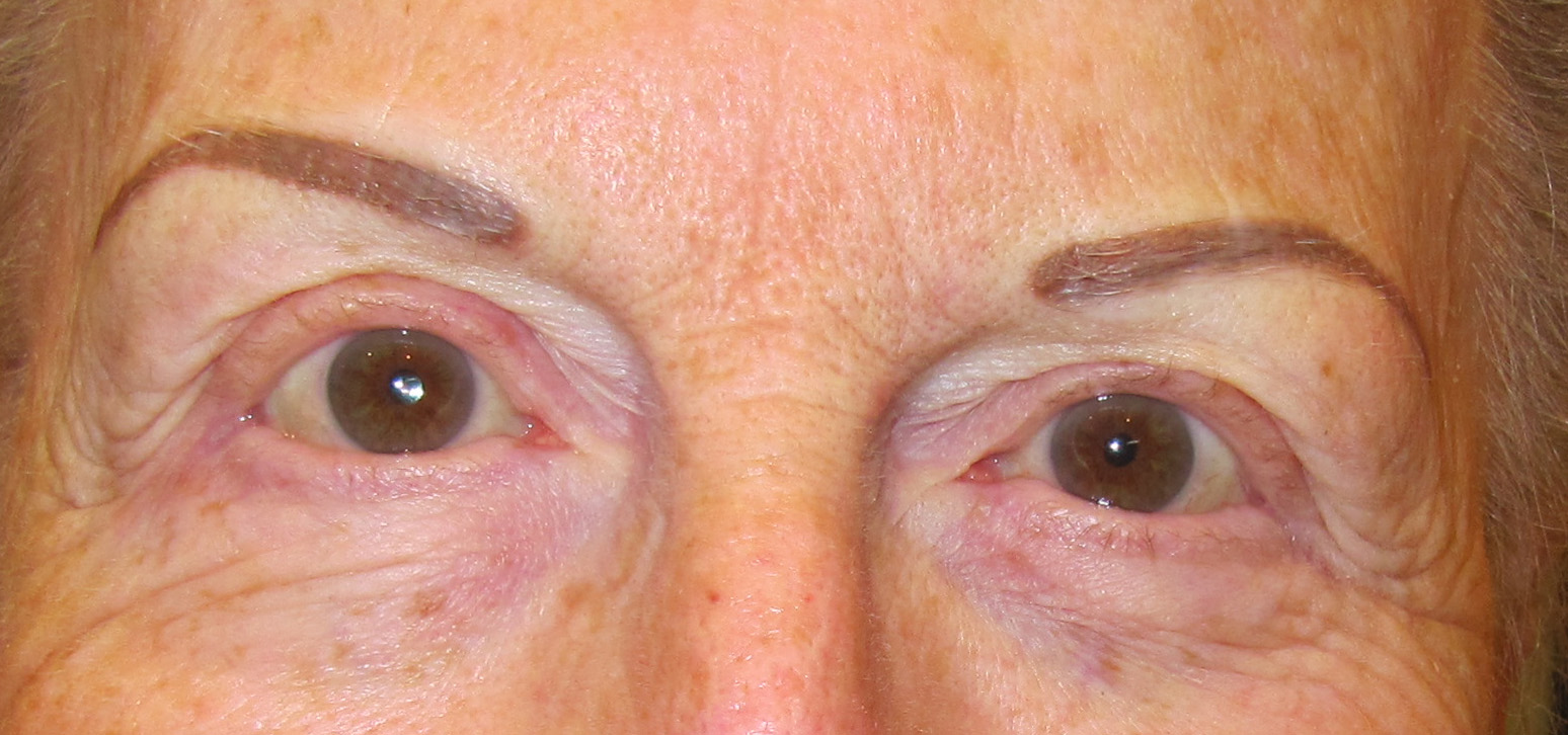 brows 32.jpg