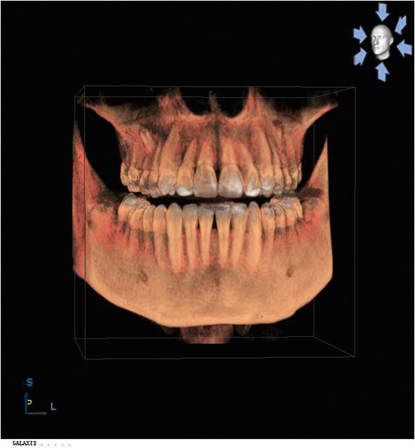 Sirona_Roentgen_ORTHOPHOS_XG_3D_Aufnahme_3D_Volumen.jpg