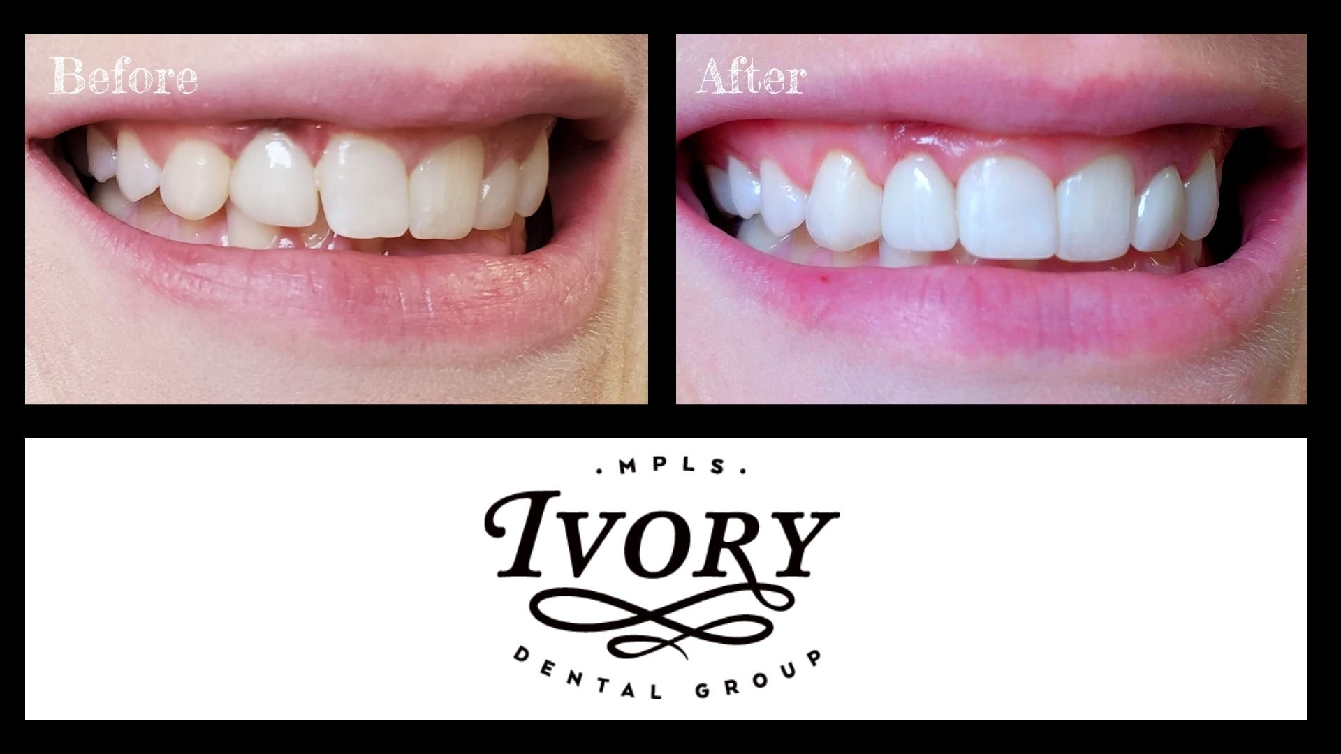 Life Changing. Beautiful. Cosmetic Dentistry - Ivory Dental Group