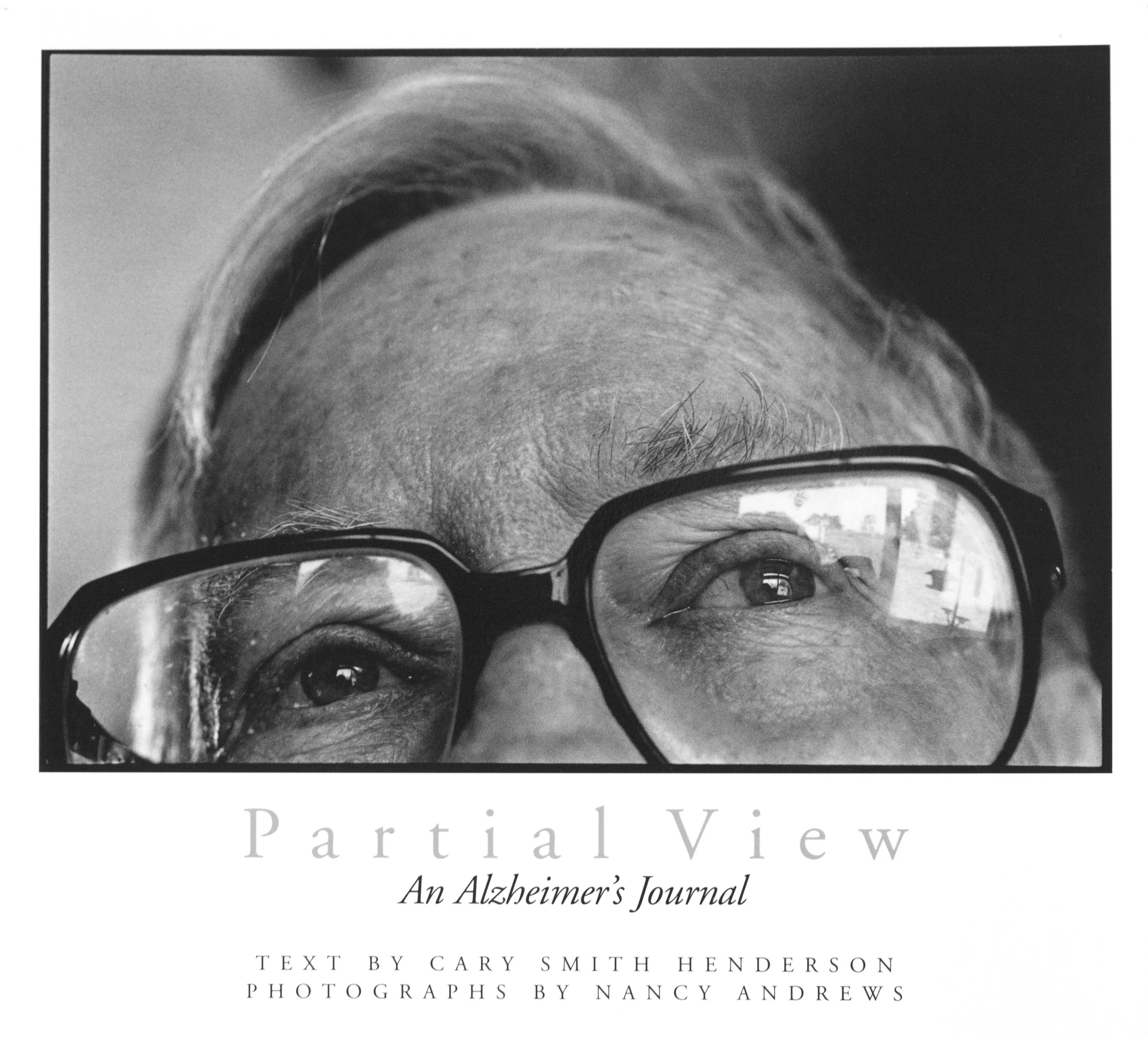 Partial View: An Alzheimer's Journal