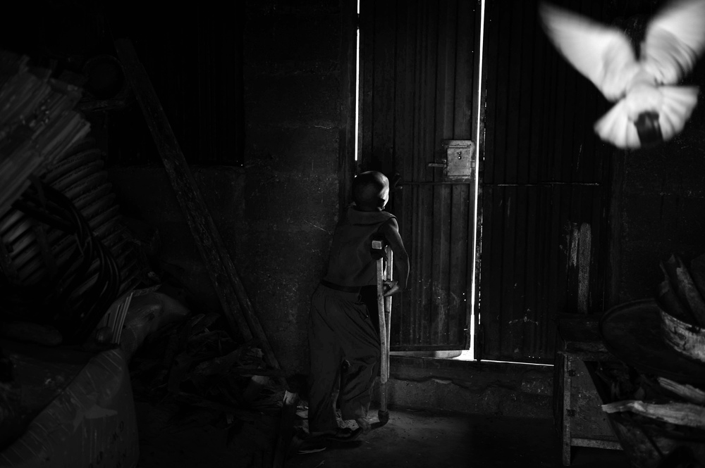   Nigeria's Polio Nightmare: UMAR, 8, stands with the help of a crutch, in the guinea fowl house at his home in Kano, Nigeria.  © Mary F. Calvert/ ZUMAPRESS.com       