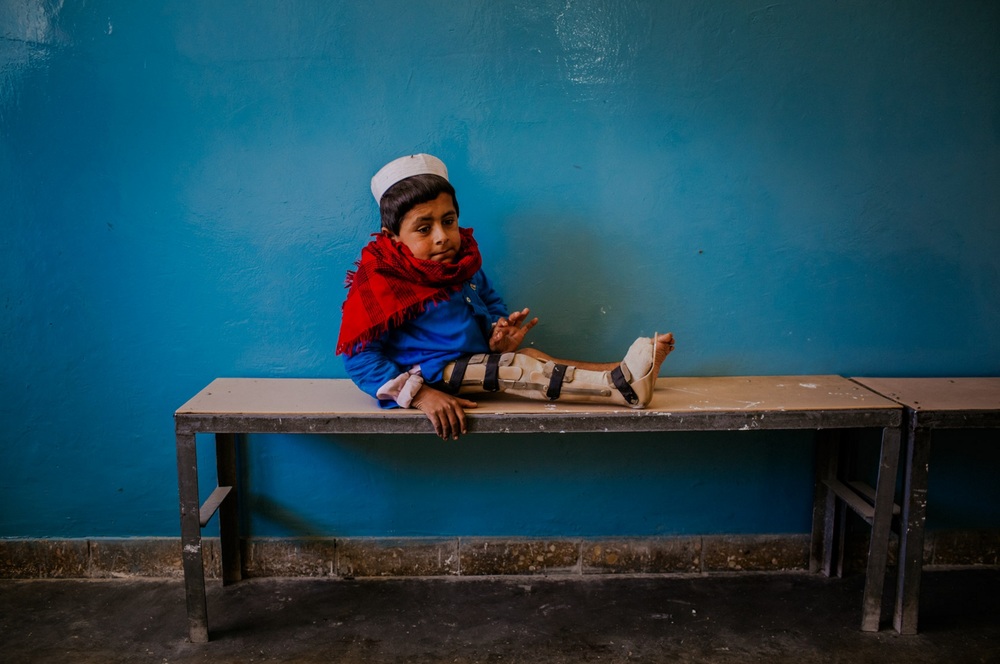   Bismillah Gul, 12, suffering from poliomyelitis waits for his father Masta Gul, after having traveled from Khost province to get treatment at the International Committee of the Red Cross (ICRC) orthopedic center in Kabul, Afghanistan. November 19, 