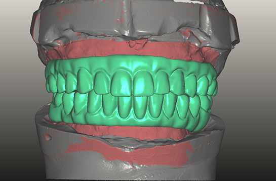 alexnguyendds-digitaldentistry1.jpg