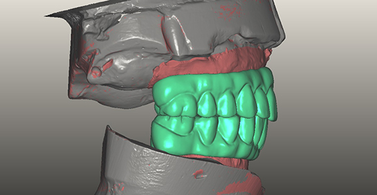 alexnguyendds-digitaldentistry2.jpg