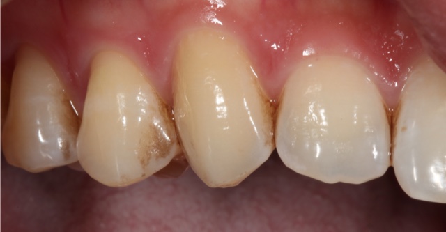 AlexNguyenDDS.StainedTeeth - 3 Necessary Variables To Consider When Picking A Dental Professional