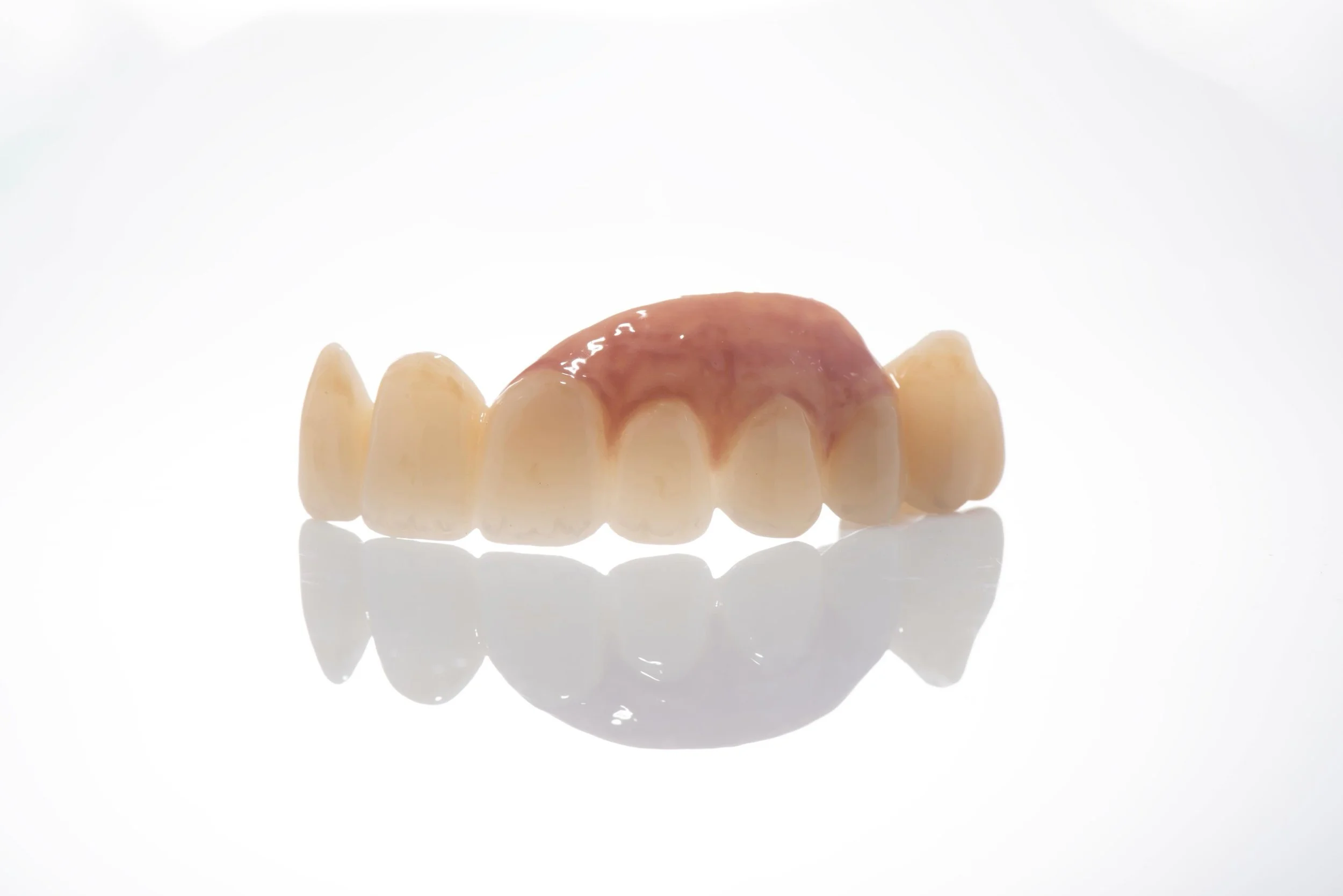 Using the latest materials and techniques we can recreate lost gum tissue in patients where extensive bone and tissue grafting is not an option. 
A smile requires not just the white esthetics, but also pink esthetics.
-
-
-
-
#dentalbridge #pinkesthe