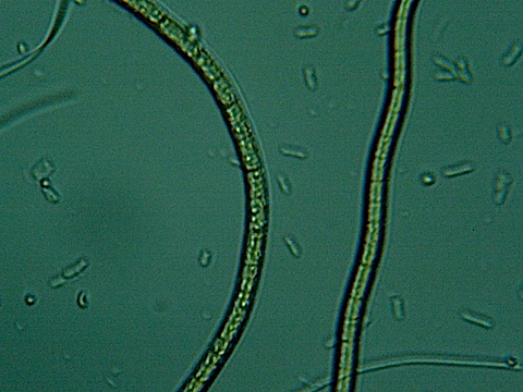 wo strands of algae (?) that seemed to move about, but maybe were just floating in the thin lens of water on the slide.