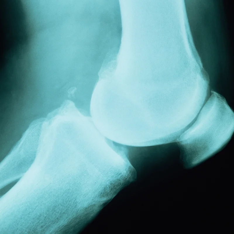 bone on bone.jpg