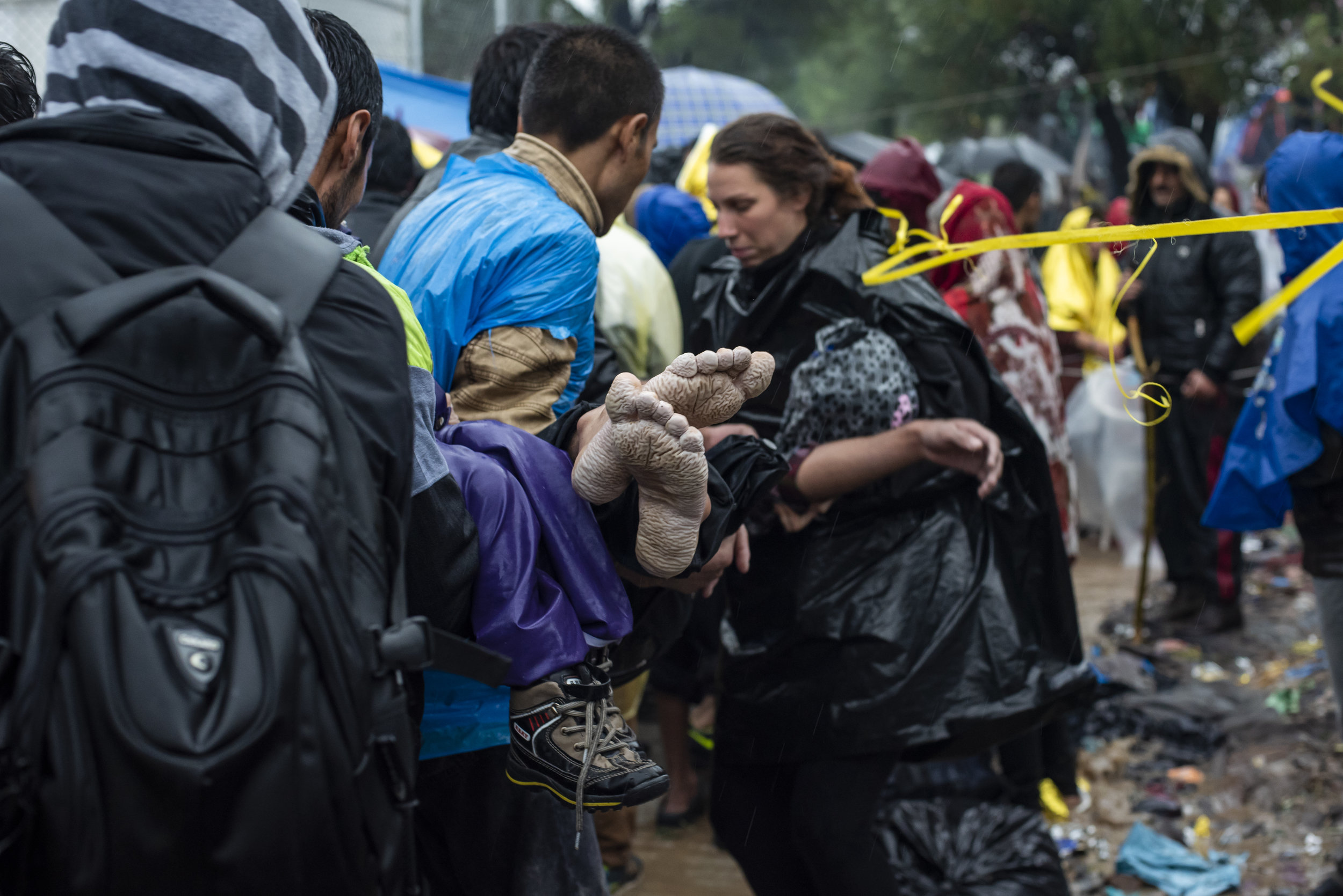  After days of rain at the Moria refugee camp in Lesvos, Greece, many people start to develop what is known as trench foot. If not treated, the skin starts to fall off, the affected area can turn gangrene and amputation may be required. 