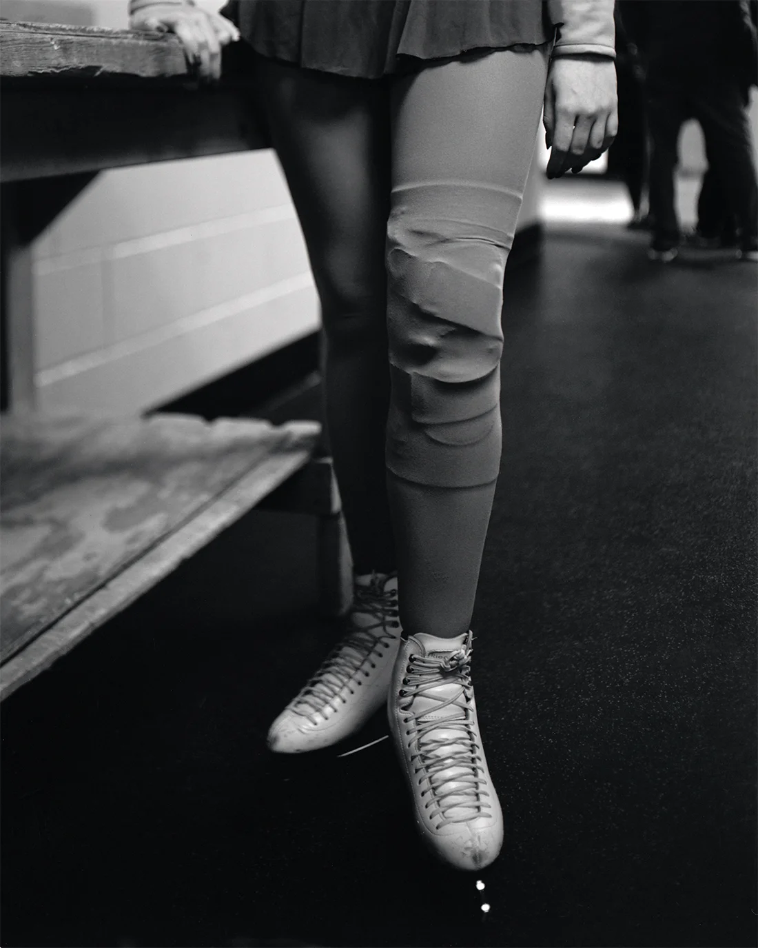 Legs