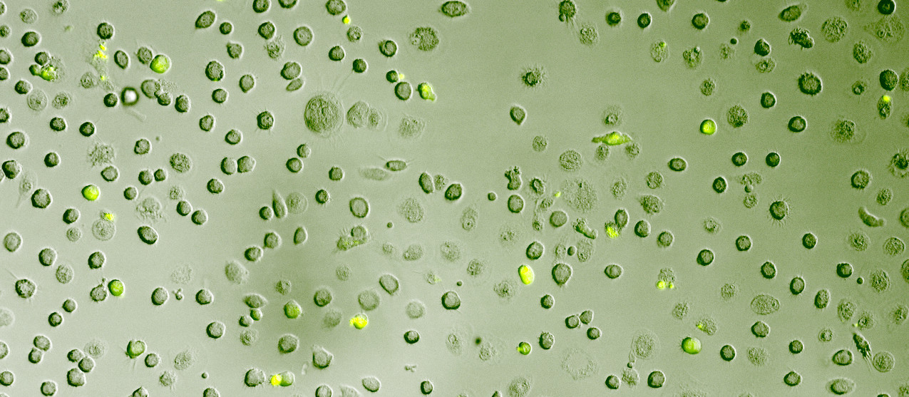 macrophages +granulocytes+CFSE overlay.jpg