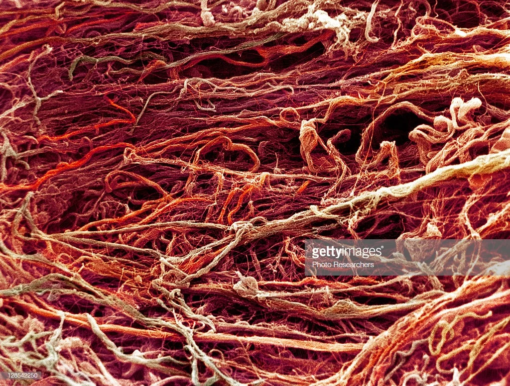 Коллаген гистология. Схема образования коллагенового волокна. Коллагеновые волокна соединительной ткани. Коллагеновые волокна рыхлой соединительной ткани. Ретикулярные волокна соединительной ткани.