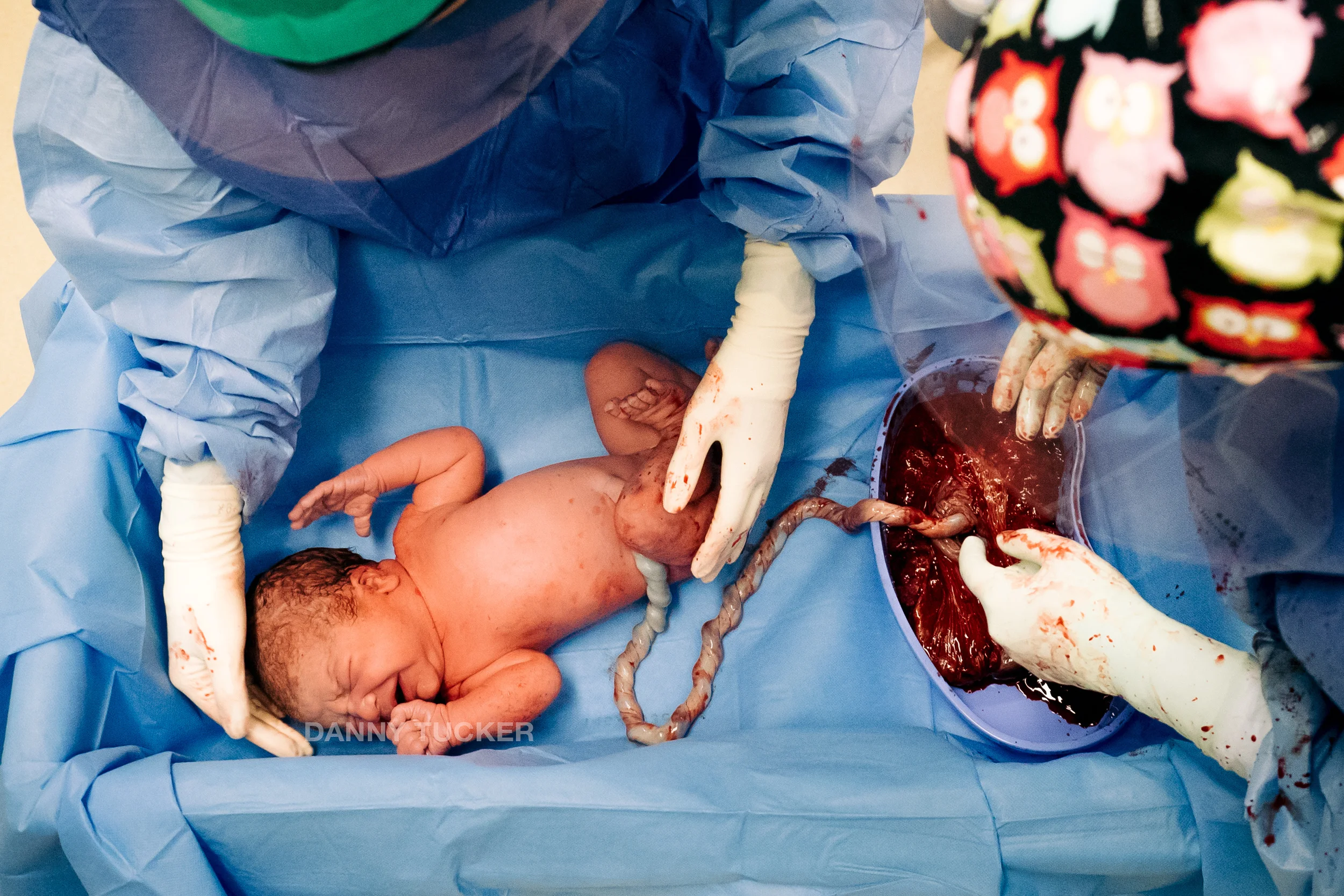 Felix's birth 2015