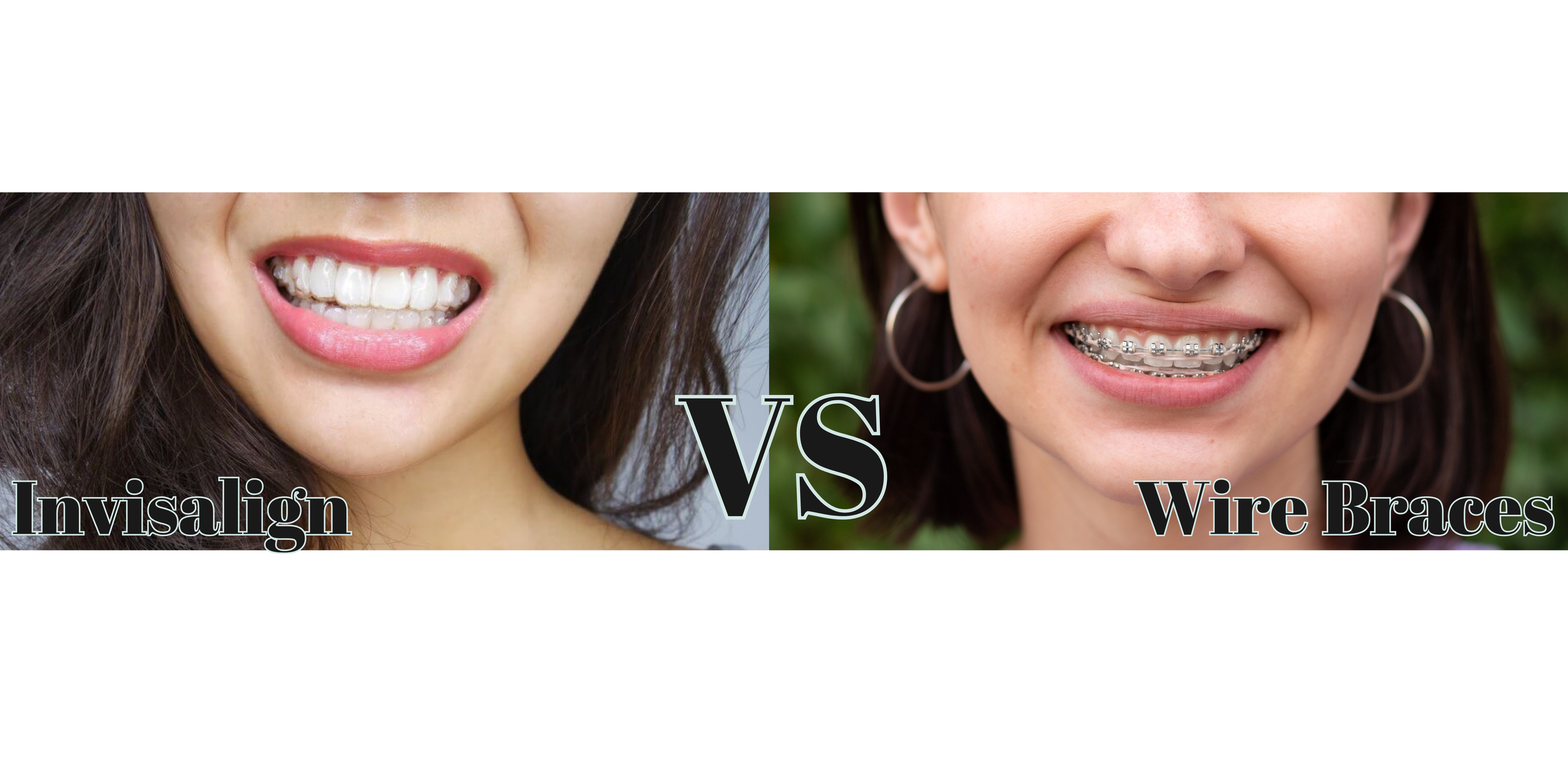 Invisalign Vs Wire Braces — Lagrange Family Dentistry