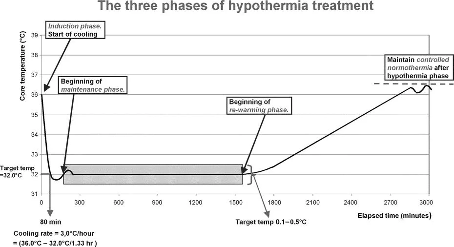 Figure 3 from the Polderman review Crit Care Med, 2009, on therapeutic hypothermia (NB: not the protocol used in this RCT)
