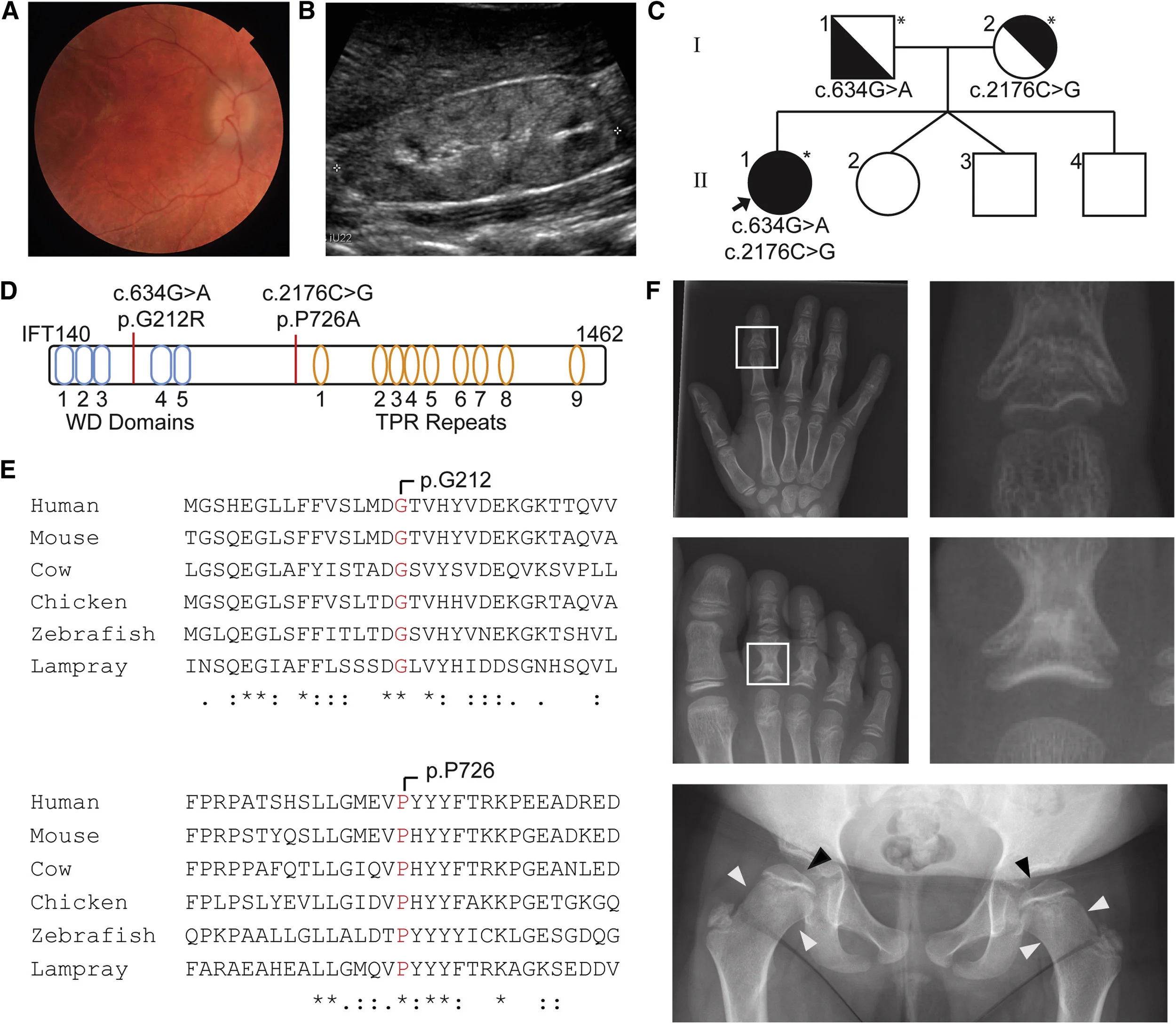 Figure 1 from Forbes et al, Am J Hum Genetics, 2018