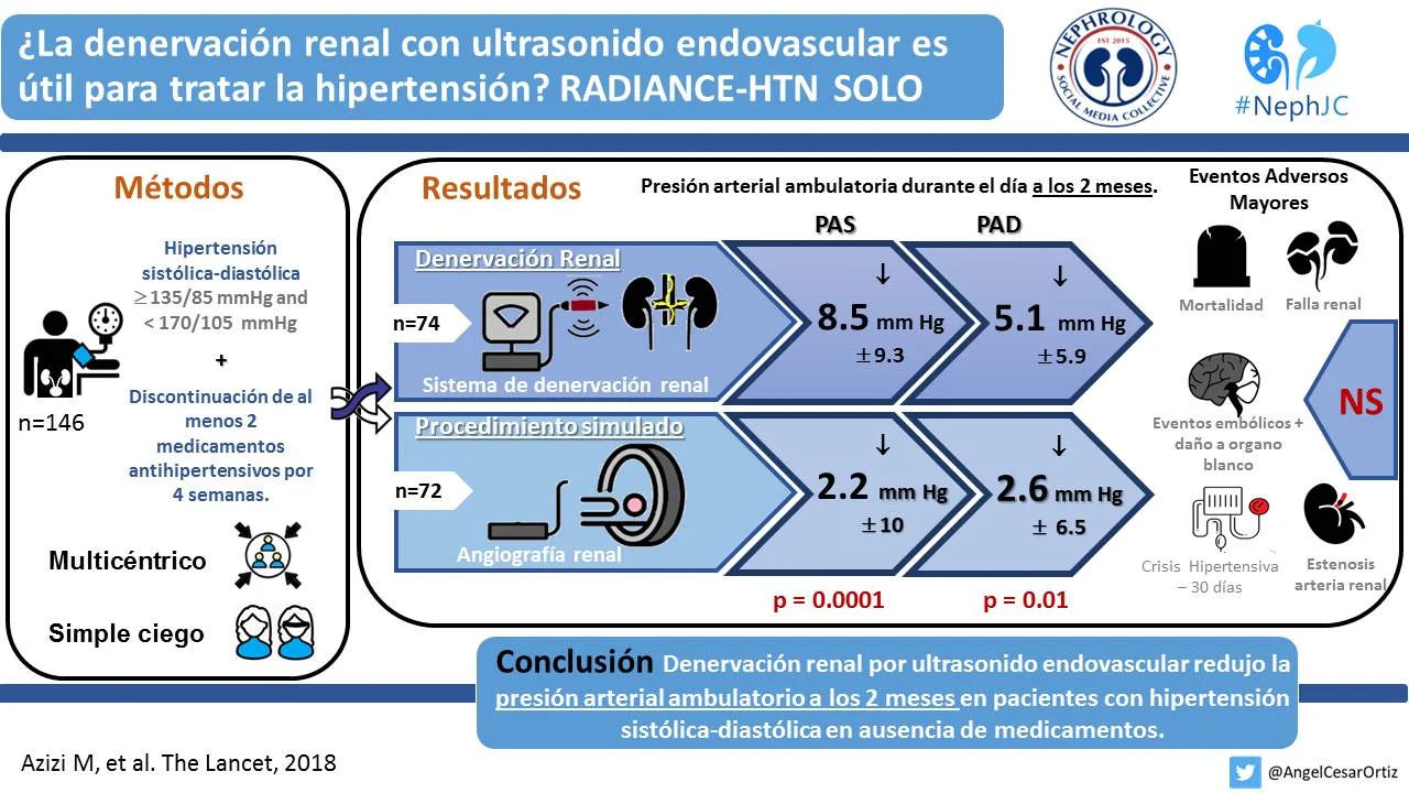 Denervación renal por ultrasonido endovascular para tratar hipertensión. RADIANCE-HTN SOLO. Lancet 2018 .jpg