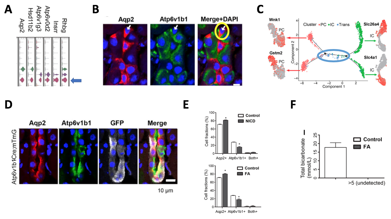 #NephJC Figure 4. (A) Adapted from Susztak Figure 1B – zooming in on violin plots of Clusters 6-8. (B) Adapted from Susztak Figure 3C. Yellow circle marks a cell expressing both Aqp2 (principal cell marker) and Atp6v1b1 (intercalated cell marker). This cell is considered a “double positive” transitional cell. (C) Adapted from Susztak Figure 3G. Monocle pseudotime trajectory shows the relationship of the different cell clusters to each other, with the novel cluster 8 being a transitional cell type between principal (pink) and intercalated (green) cells. (D) Adapted from Susztak Figure 3I. ATP6ase lineage tag is marked by GFP. Cells with green, red, and white are transitional cells. (E) Adapted from Susztak Figure 4C and E. More principal cells were present in cell fractions. (F) Adapted from Susztak Figure 4I. Folic acid treated mice had undetectable serum bicarbonate levels.