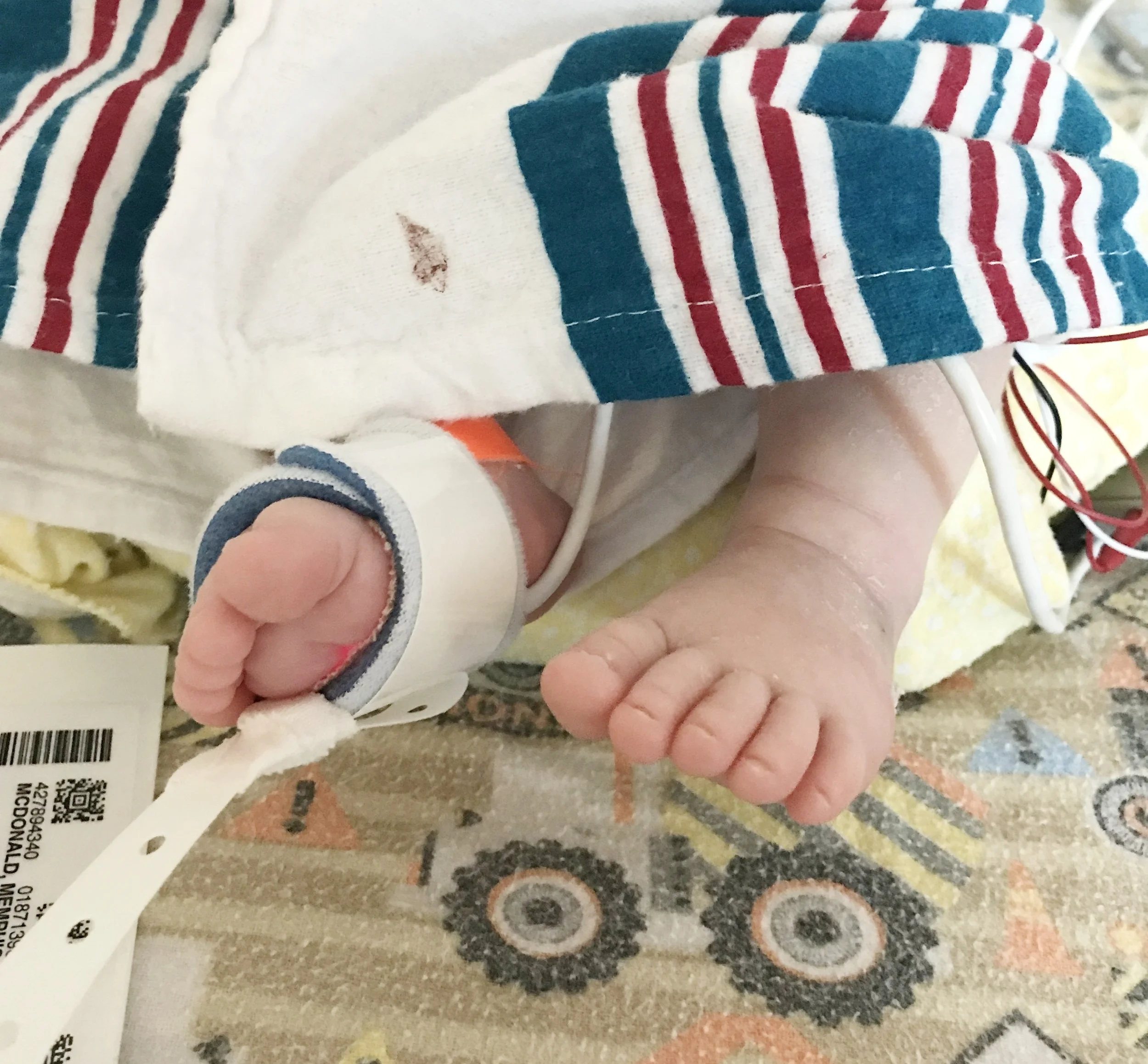Becoming a NICU parent