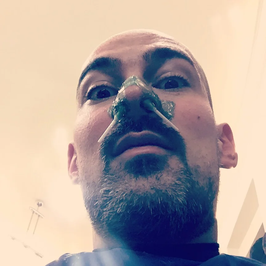 Come ho scoperto l'esistenza di peli che manco sapevo di avere.