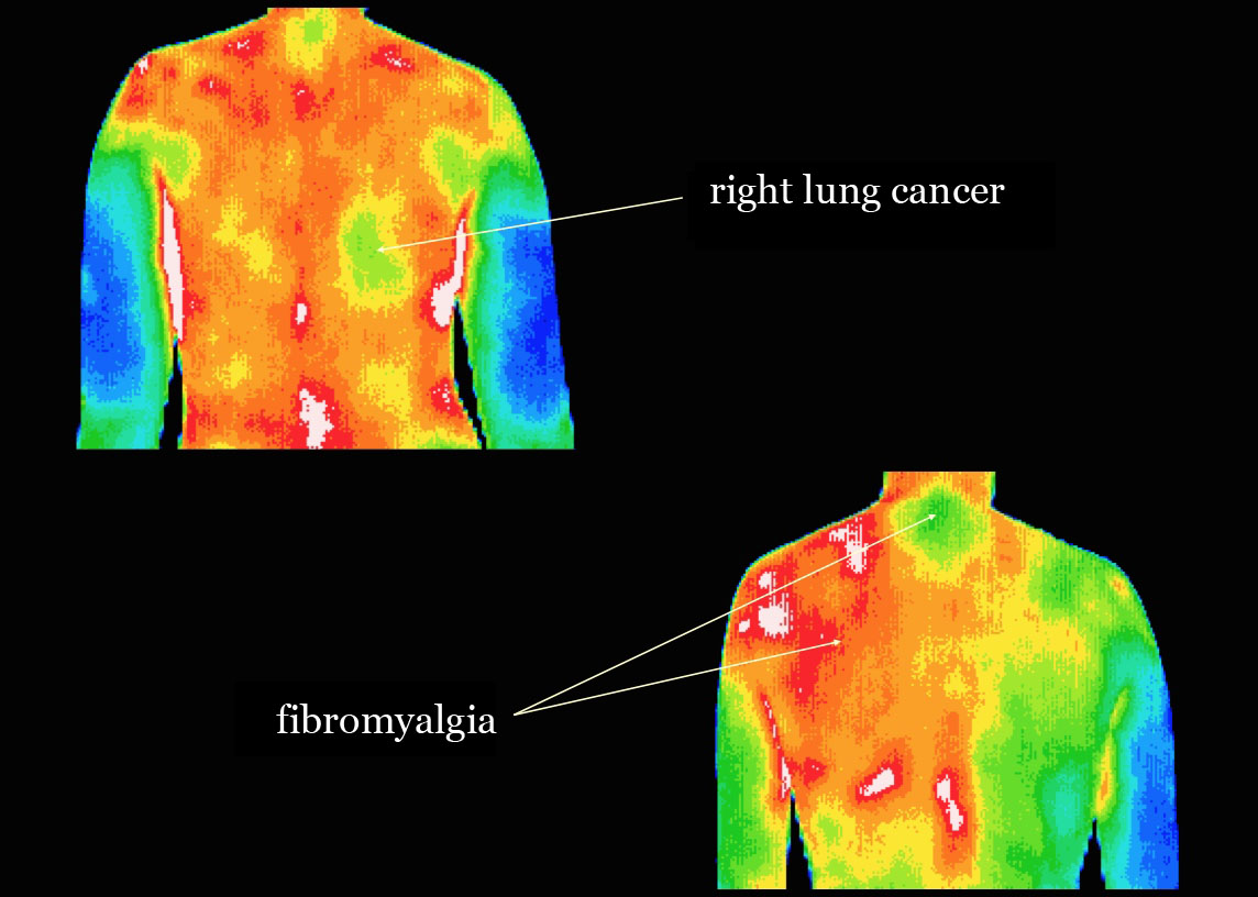 thermography clinic near me