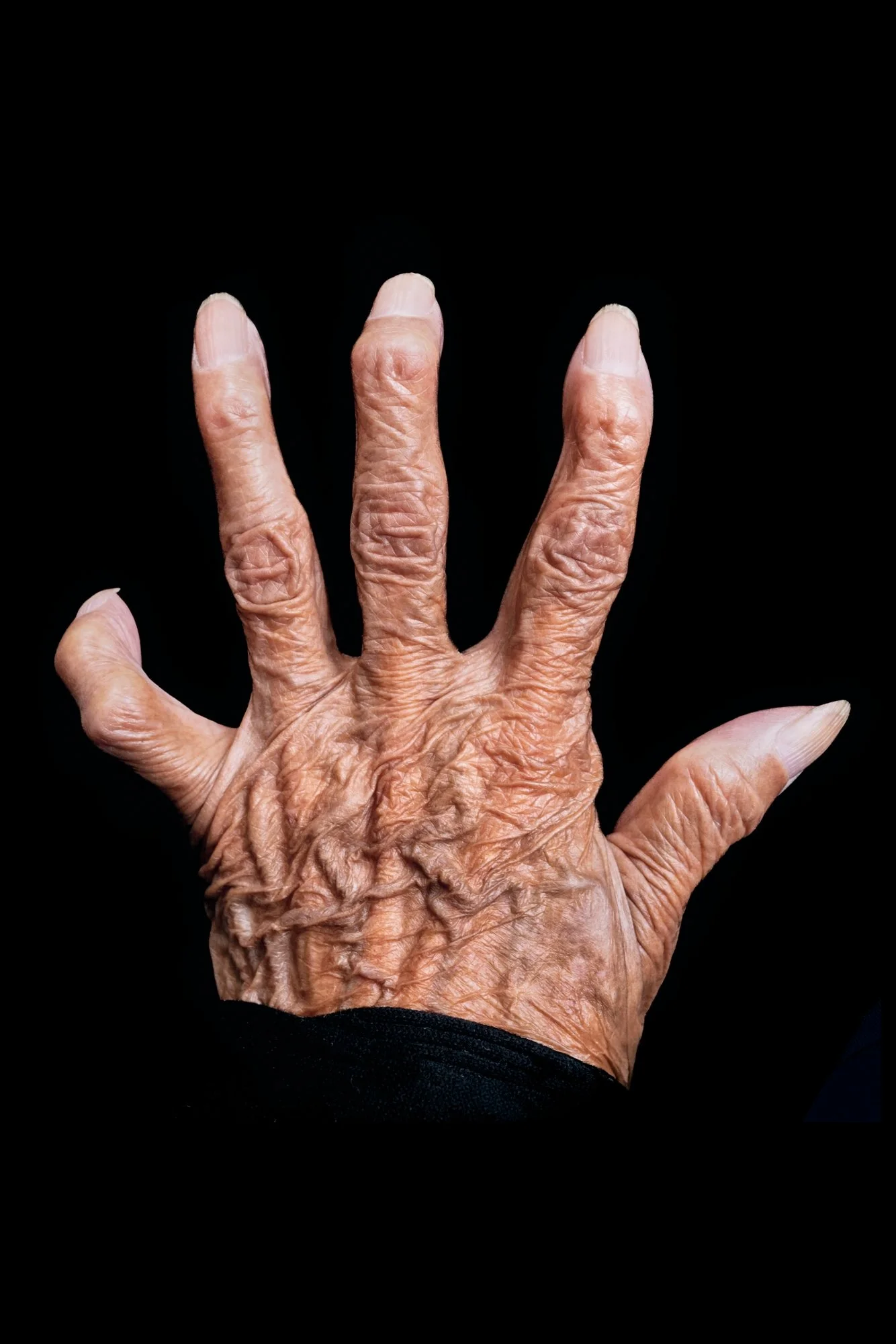 CARNAL_MANO2_S.GERBAUD.jpg