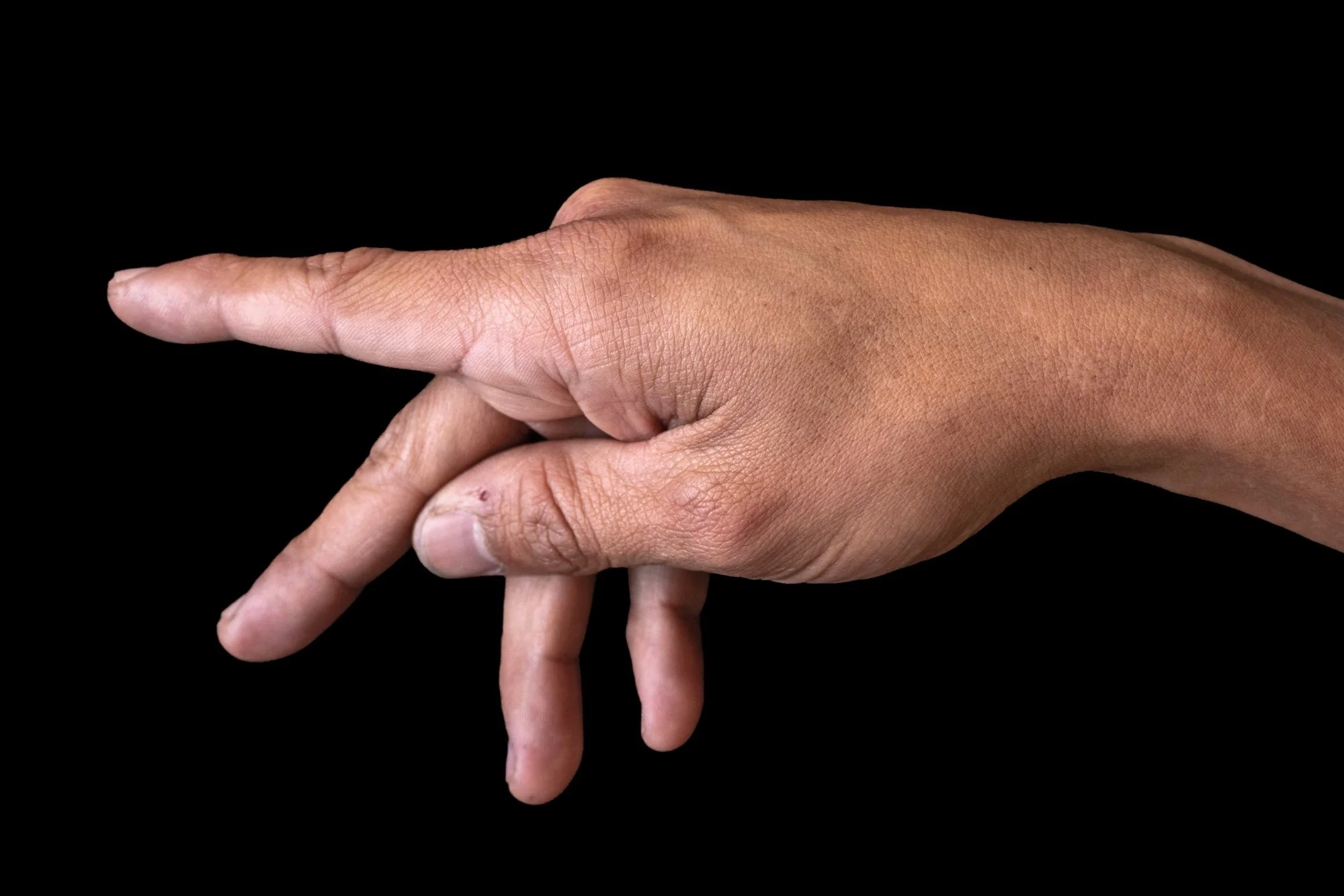 CARNAL - installation