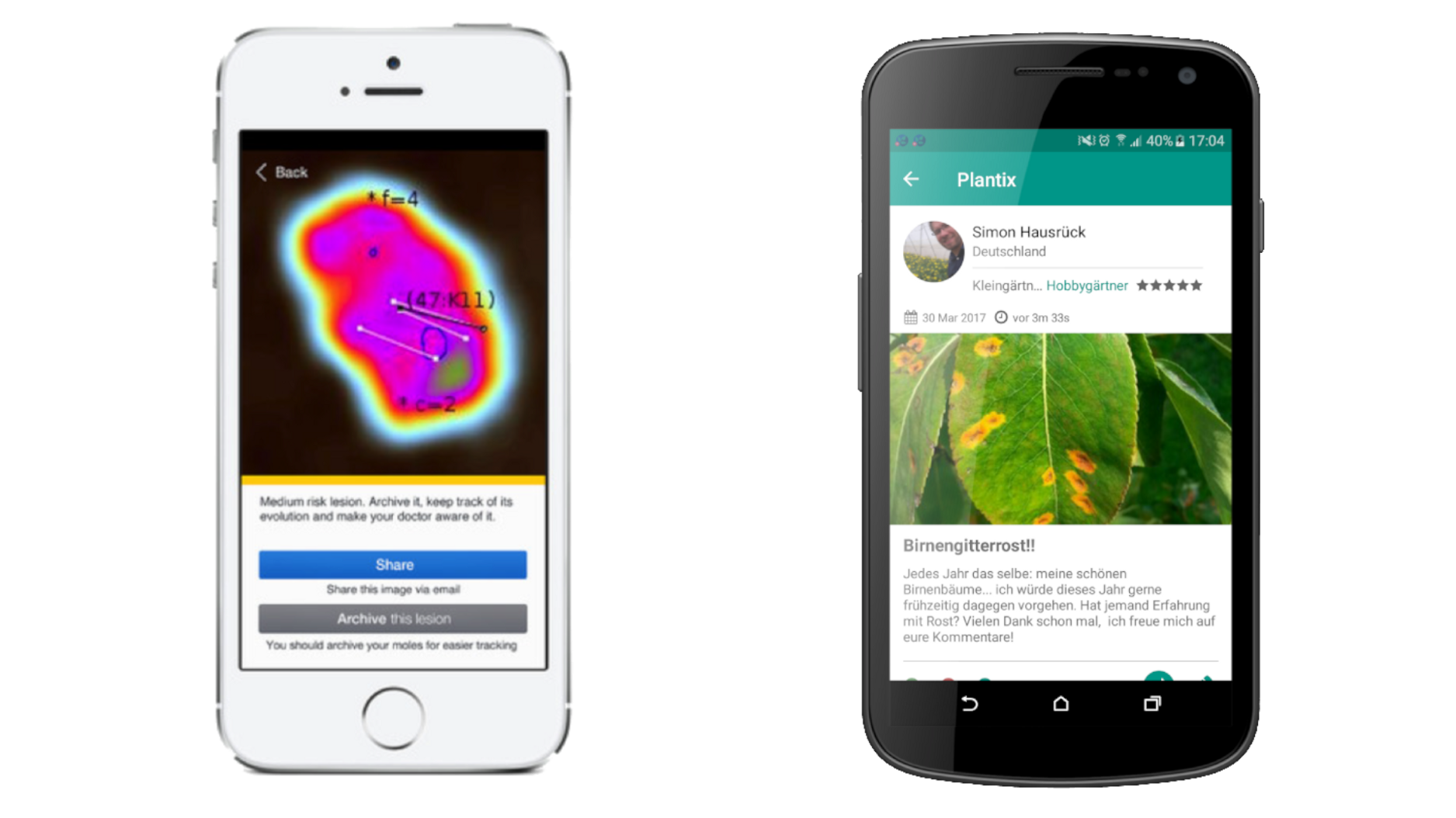 AI is obviously going to kill us all and replace us with paperclips. In the meantime, you can use it to spot skin cancer or diseases on your crops.