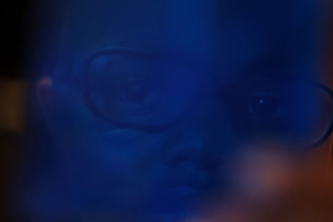  Carter Overton, 5, looks through a magnetic building block in his bedroom on Sept. 28, 2023, in Sedalia, Mo. As a result of hydrocephalus, Carter has poor eyesight and often uses touch or holds items closely to see them properly. 