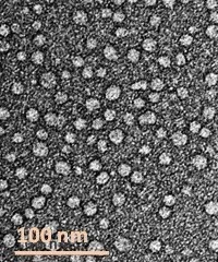TEM image of nanodiscs containing LHCII