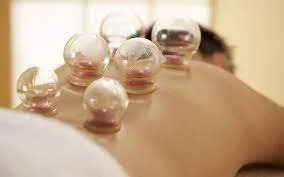 Cupping