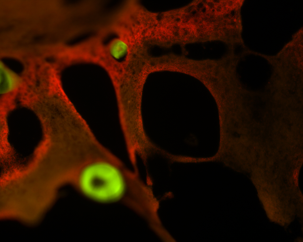  Photosymbionts like cyanobacteria can also visualized&nbsp;using fluorescence microscopy 