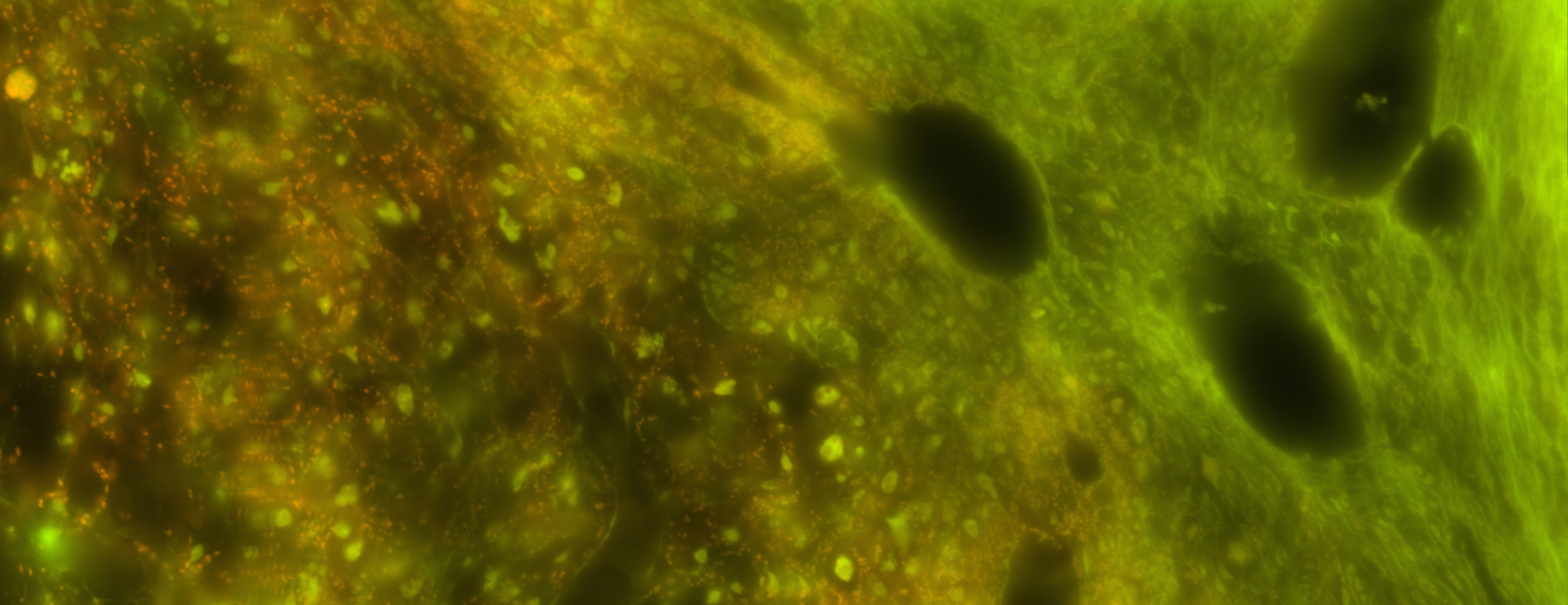 A photo-transect of cyanobacterial symbionts (orange dots) in a cross section of a Caribbean sponge 