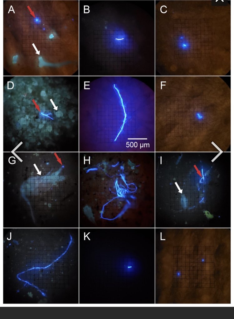  Microplastics found in sponge tissue 