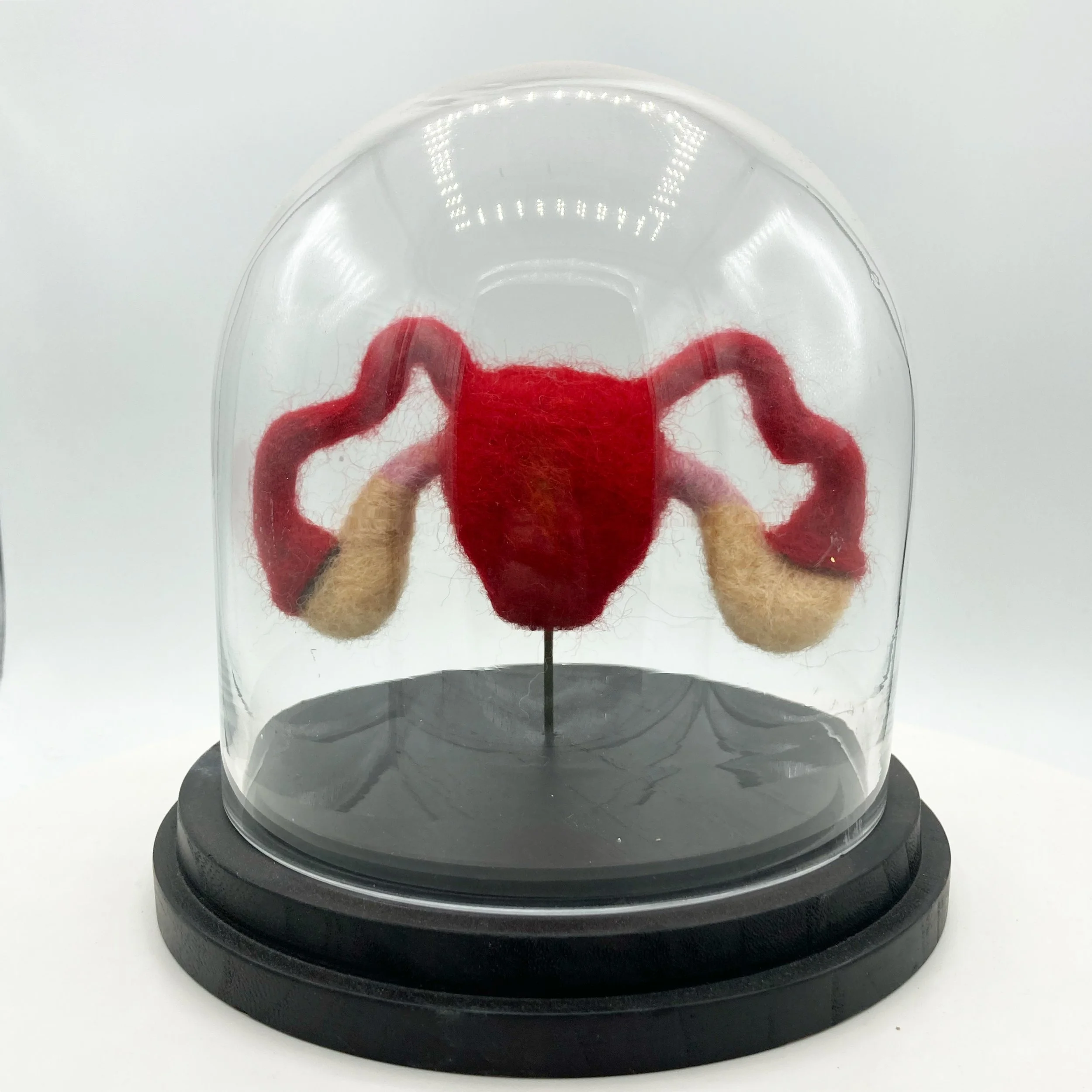 Female Reproductive System - Uterus and Ovaries