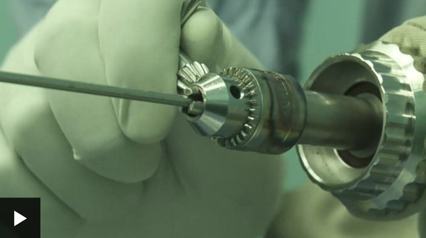 Fixing bones with a household drill BBC | December 2014