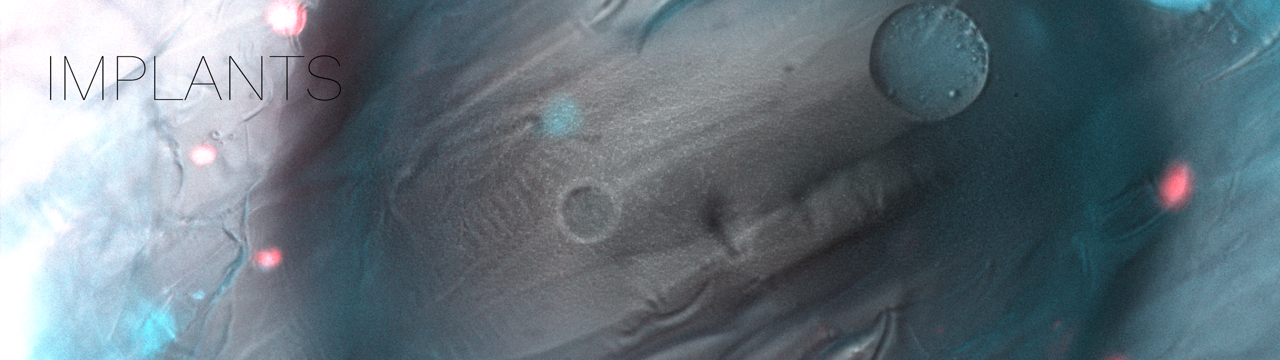 Close-up of medical syringes and vials with the text 'IMPLANTS' in the top left corner.