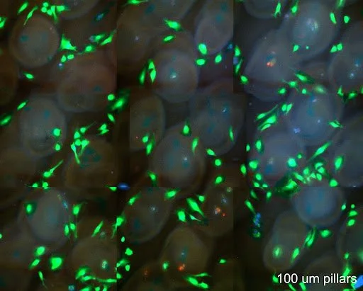 Close-up of small, translucent, round objects with green and blue glowing spots, resembling microscopic biological structures or minerals under a microscope.
