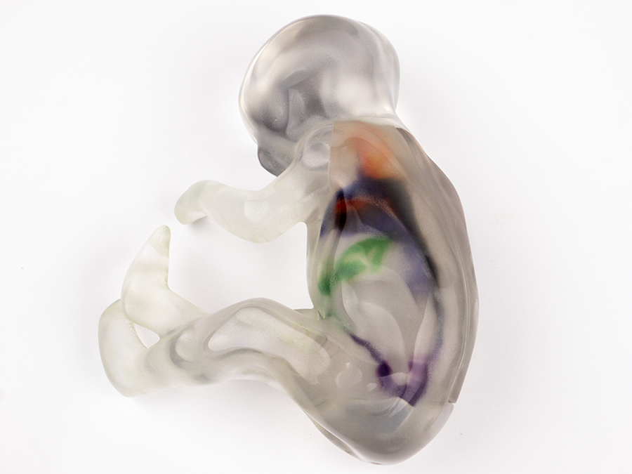 Fetal 4D Flow Voxel 3D Printed Model from MRI